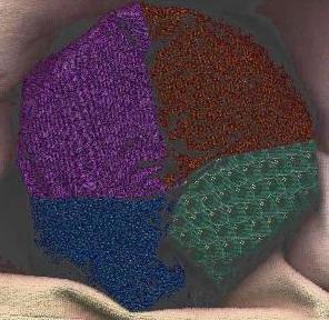2-torus with hyperbolic octagon